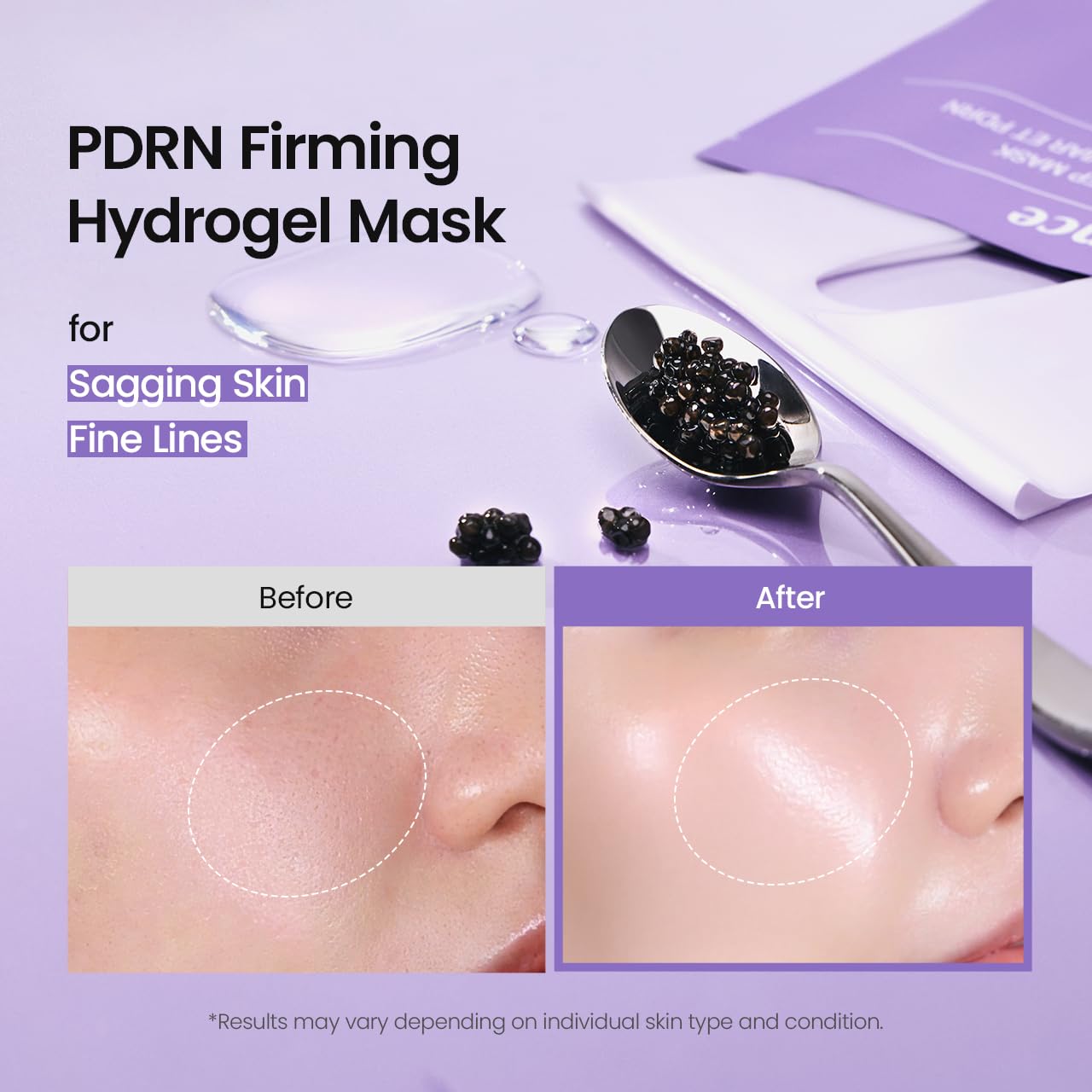 BIODANCE Rejuvenating Caviar PDRN Real Deep Mask, Overnight Hydrogel Face Mask, Skin Firming, Radiance, Enhancing Skin Recovery, Korean Skin Care, Mothers Day Gifts | 1.19oz(34g) x 4ea